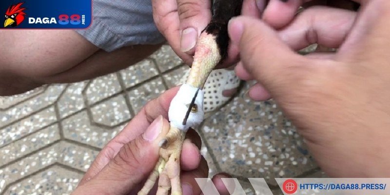 Cách băng cựa gà Thomo giảm chấn thương